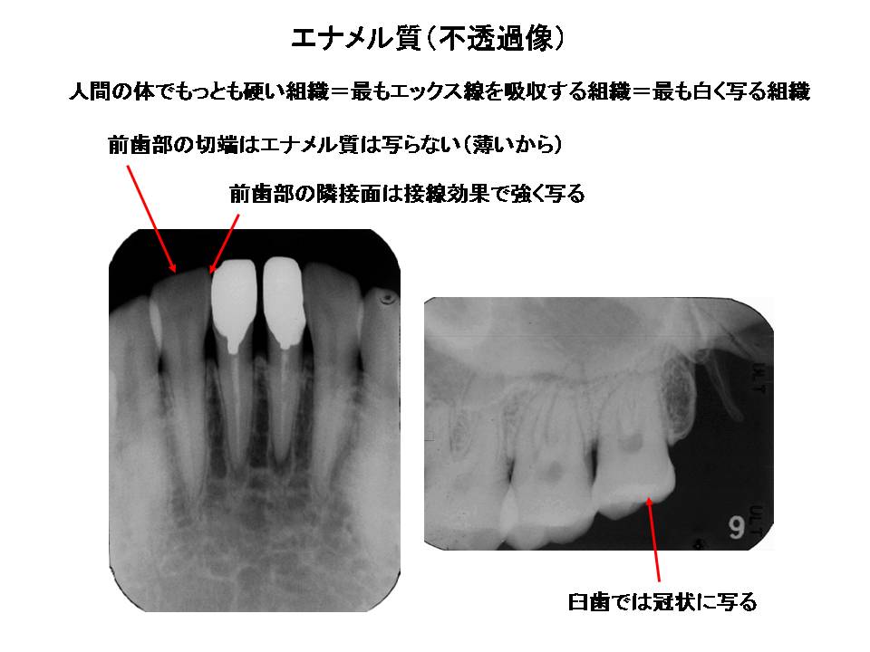 デンタルエックス線写真 口内法（二等分法・咬合法）撮影の解剖