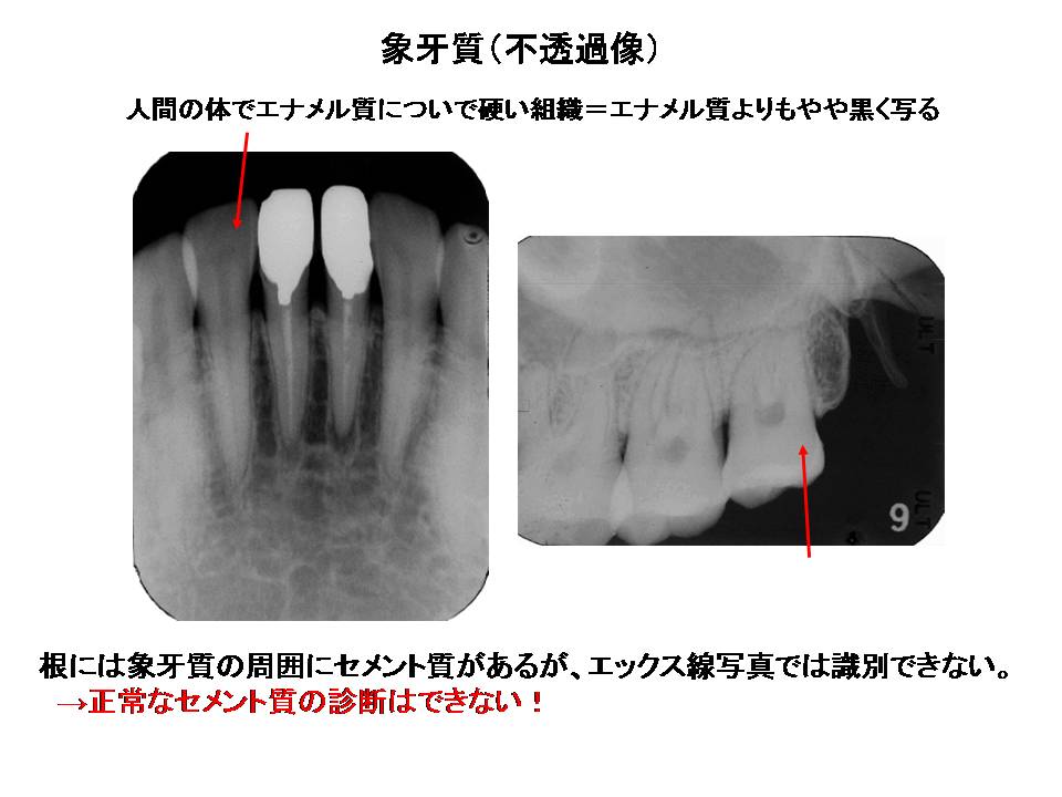 デンタルエックス線写真 口内法（二等分法・咬合法）撮影の解剖