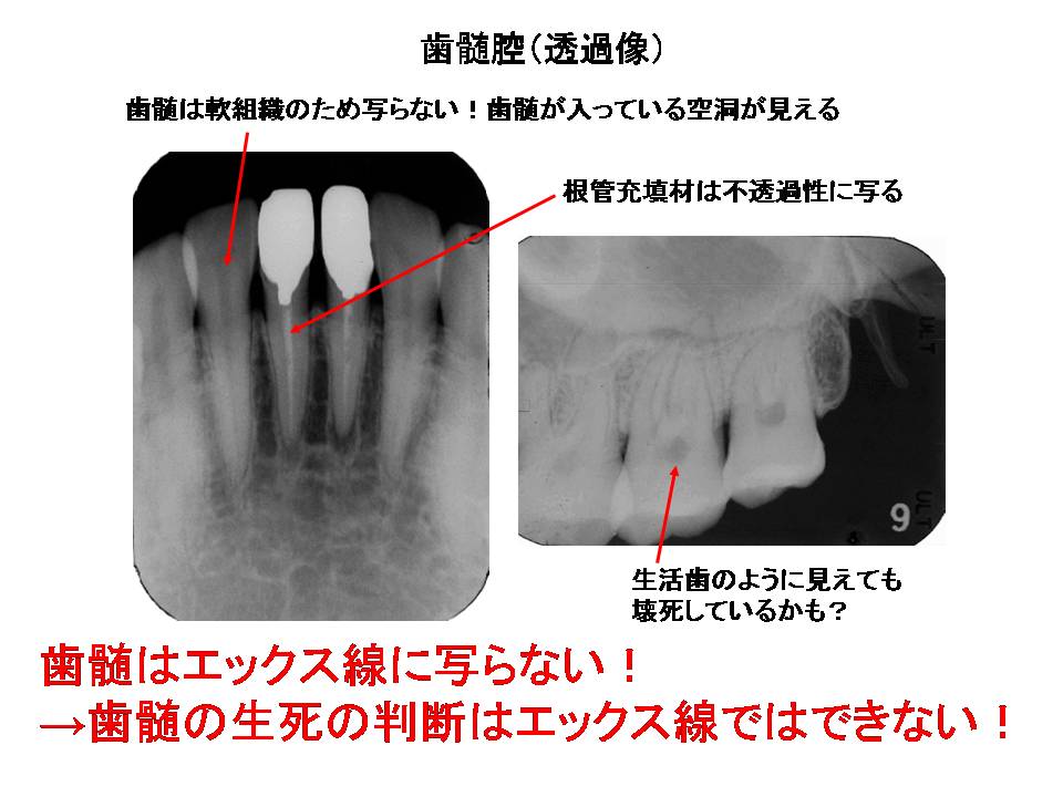 口内法（二等分法・咬合法）撮影の解剖