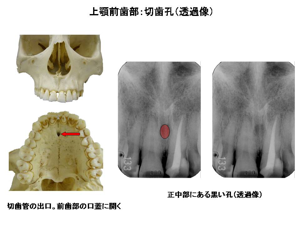 口内法（二等分法・咬合法）撮影の解剖