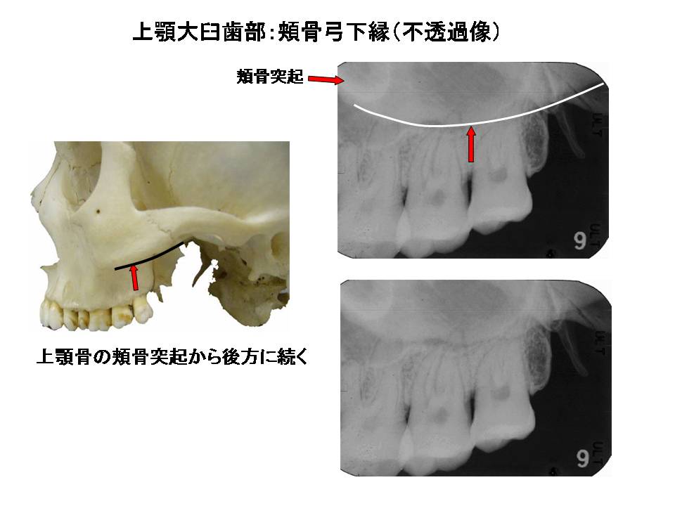 デンタルエックス線写真 口内法（二等分法・咬合法）撮影の解剖