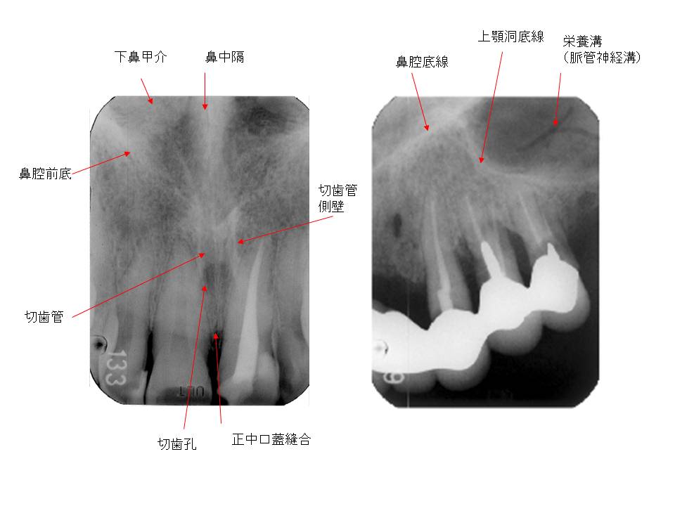 口内法（二等分法・咬合法）撮影の解剖
