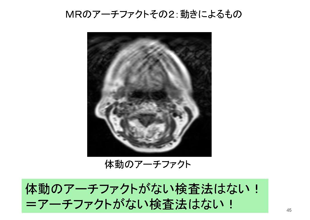 炎症の画像診断