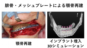 口腔・顎顔面外科学講座について | 福岡歯科大学